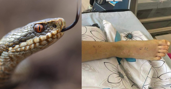 Գյուրզա օձը 2 անգամ կծել է 12-ամյա տղայի