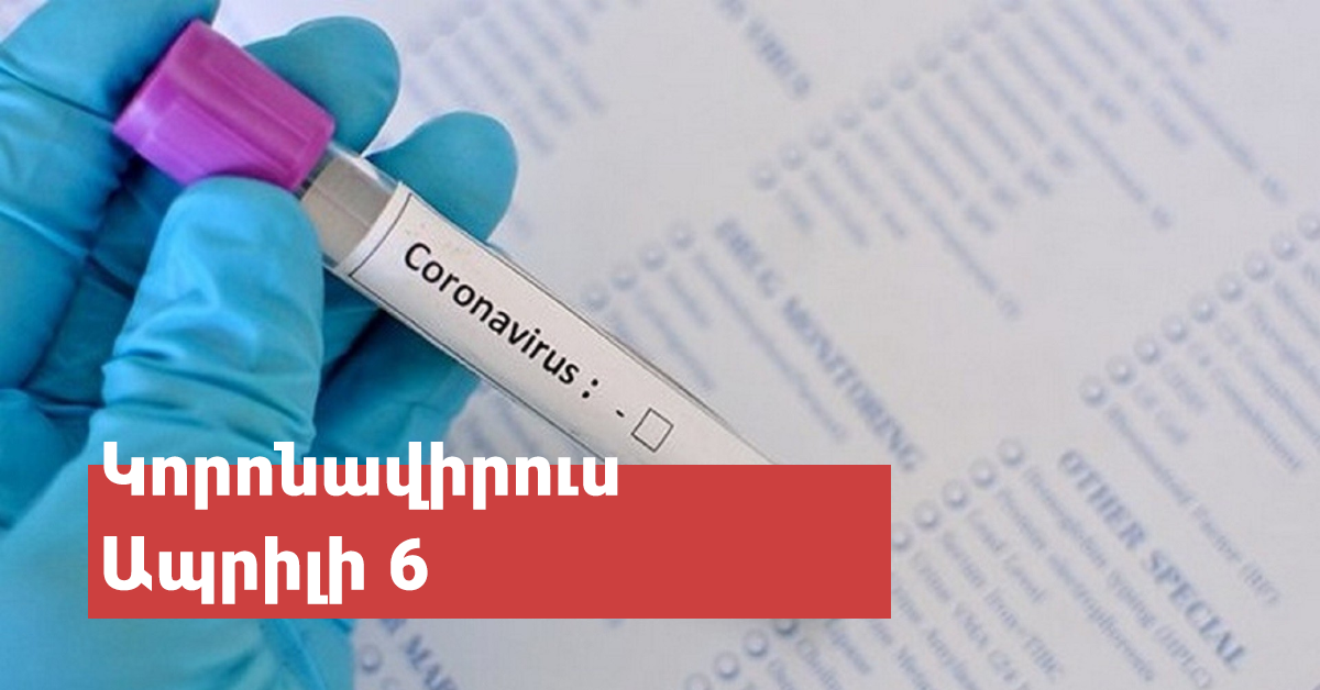 Այսօր ՝ ապրիլի 6-ի դրությամբ կորոնավիրուսով վարակվածների թիվը